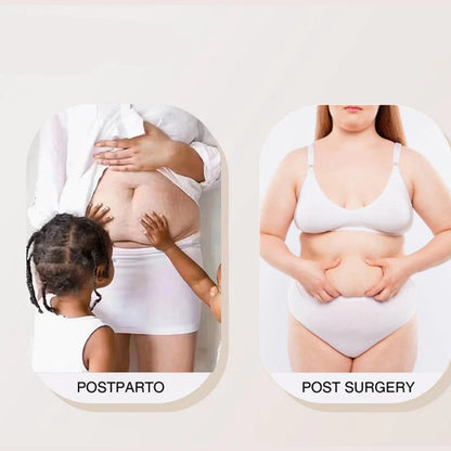 Women's Zip-Up Shapewear Bodysuit – Instant 360° Tummy Control & Lift 🩱