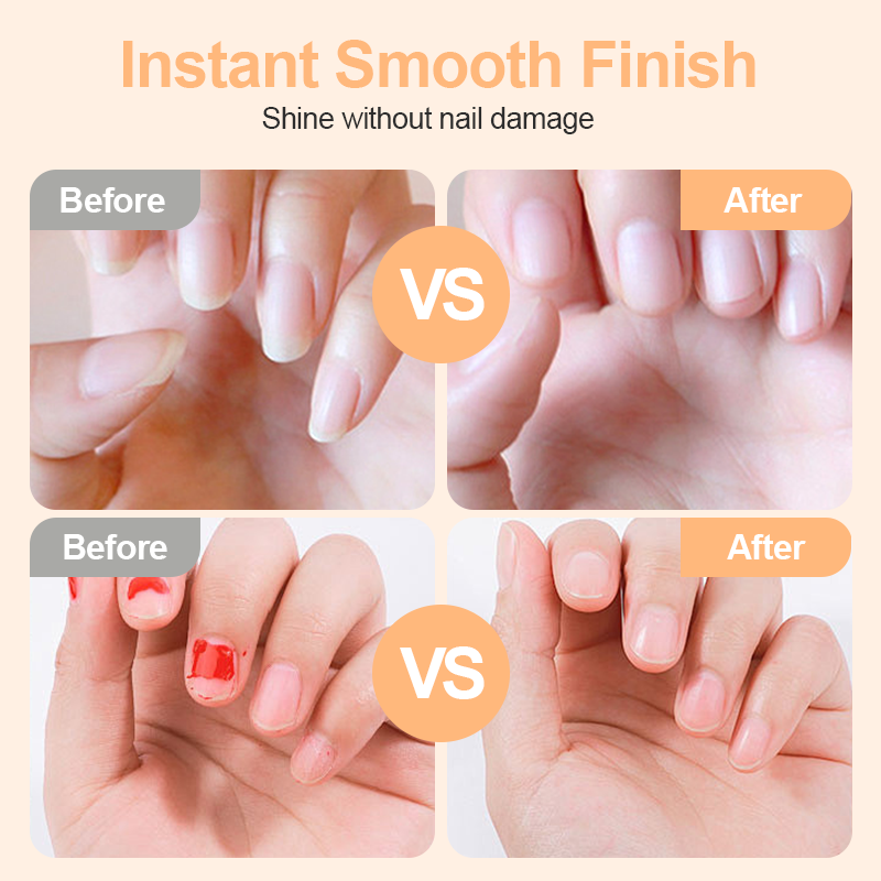 💗LAST DAY SALE 60% OFF⚡50K+ SOLD💕🌟2-in-1 Safe Electric Nail Clipper