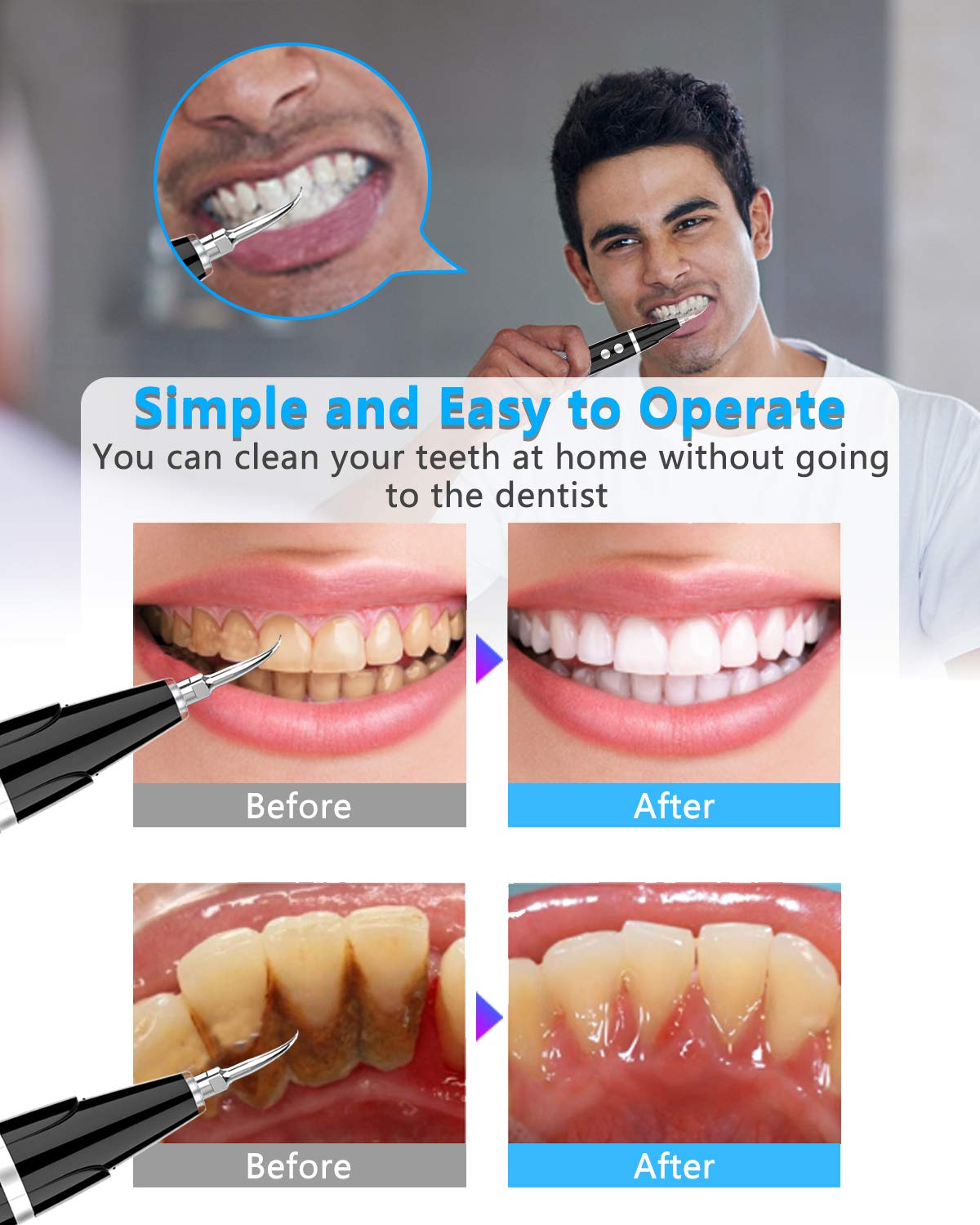 Ideal Gift - Electric Teeth Cleaner